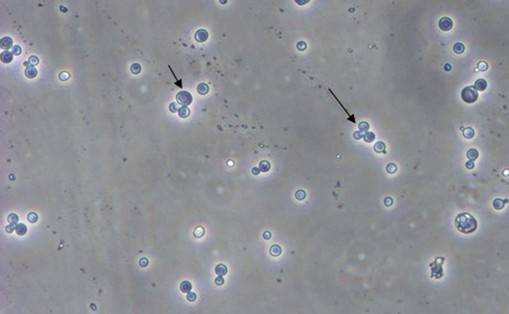 酵母双杂交技术原理、试验流程、特点以及应用
