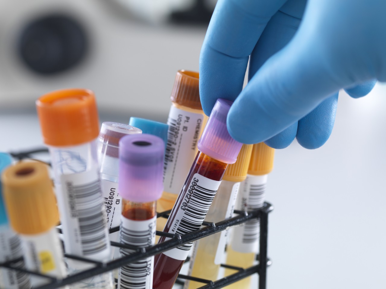 一致性评价大幕开启，医院市场即将调整