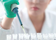 Science子刊：一种新模型可预测微粒制剂的可注射性