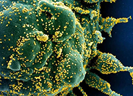 唾液检测新冠抗体新方法来了，获取结果仅需几小时！