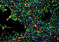 世界首创：药物将干细胞引导至受损部位，提高其愈合能力！
