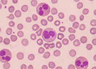 一种神秘颗粒被发现了！它能否成为败血症早筛标志物？