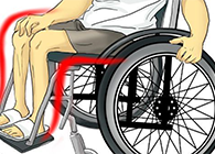 Nature：还瘫痪患者一个自由身的日子不远了